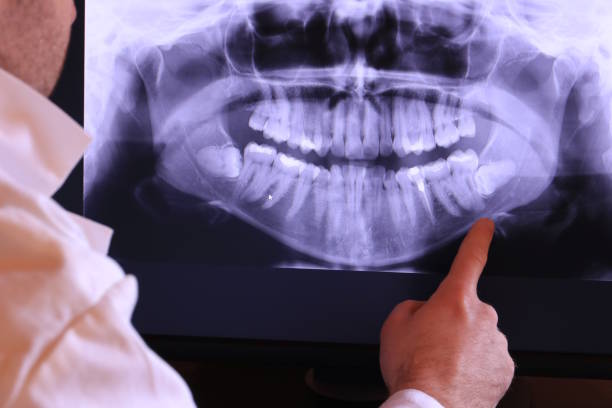 Best Emergency Treatment for Dental Infections or Abscesses in Ocoee, FL